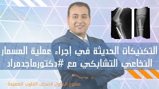 التكنيكات الحديثة في إجراء عملية المسمار النخاعي التشابكي مع #دكتورماجدمراد