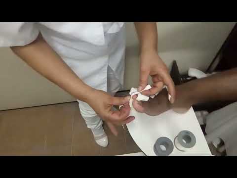 Vídeo: Como curar um dedo do pé quebrado: 13 etapas (com fotos)