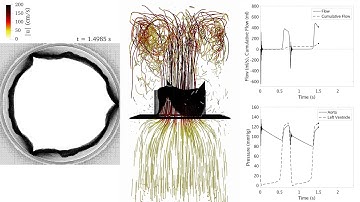 M3 Aortic valve simulation, physiological pressure pathlines 10x slow motion