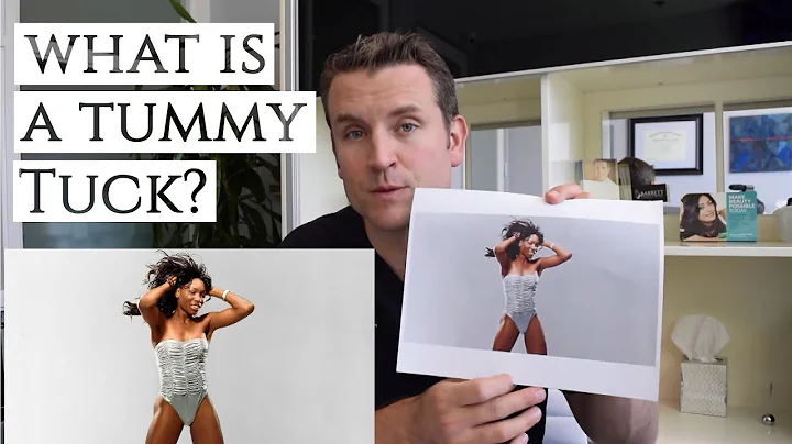 What is a Tummy Tuck? | Is it Right for Me? | Dr. ...