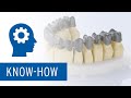 Ceramill sintron  create longspan bridges with bridge split