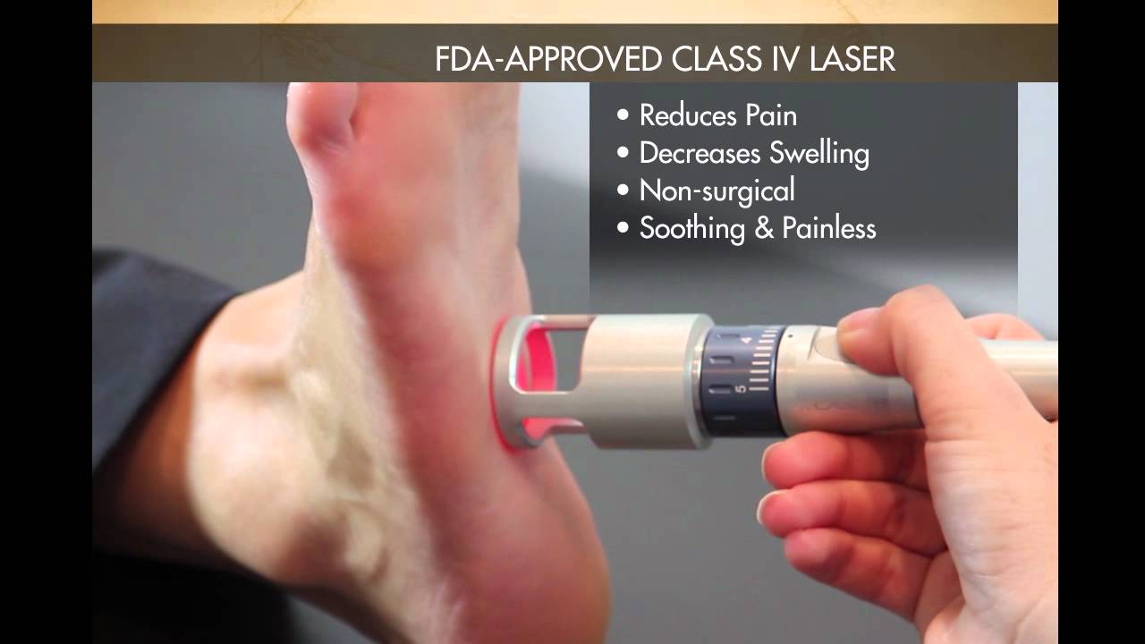 Lasera Treating Foot Pain / Plantar Fasciitis with Laser Therapy YouTube