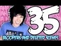 QNA 35 Bloopers and Deleted Scenes