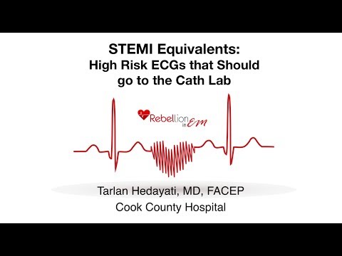 STEMI Equivalents - Tarlan Hedayati, MD