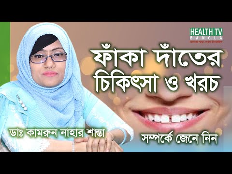 ফাঁকা দাঁতের চিকিৎসা ও খরচ | Faka Dater Treatment & Cost | Gap Between Teeth Treatment & Cost