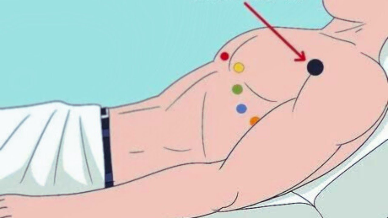 How to Put ECG Leads on a Chest