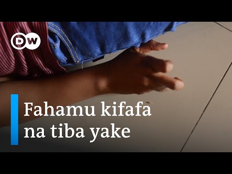 Video: Je, kifafa cha homa ni aina ya kifafa?