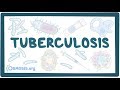 Tuberculosis  causes symptoms diagnosis treatment pathology