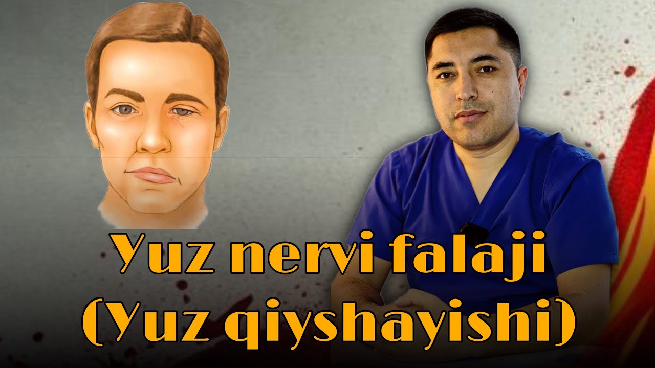 YUZ NERVI FALAJI (yuz qiyshayishi) | Nevrolog Nazirov Shuhratjon Yuldashevich