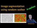 24 - Random Walker segmentation in Python