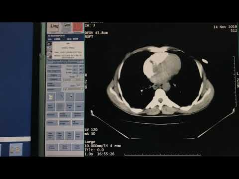 ازاي اشتغل فحوصات الأشعة المقطعية بالصبغة باستخدام Smart Prep GE CT 
