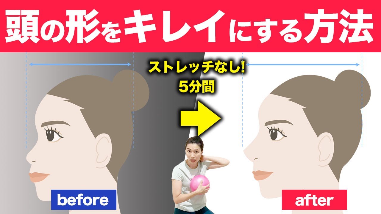 絶壁頭が改善した骨格のしくみとセルフケアを紹介します！
