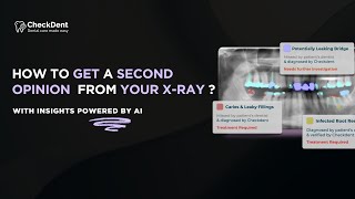 How To Upload Your X-Ray Get Instant Second Opnion