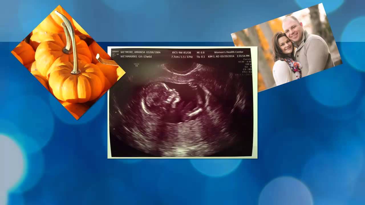 Jon and Amanda's Baby