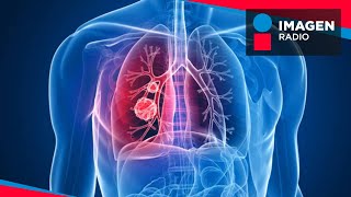 Cáncer pulmonar: Tipos y principales factores de riesgo