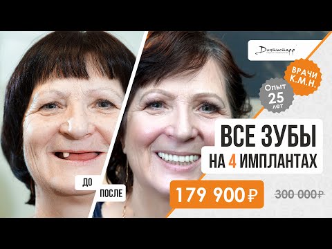 Восстановление всех зубов до/после. +7 (495) 255-59-37 Чудесное преображение пациентки! 18+