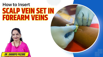 How to Insert a Scalp Vein Set in Forearm Veins | Step-by-Step Guide | MBBS, BAMS, ANM, GNM