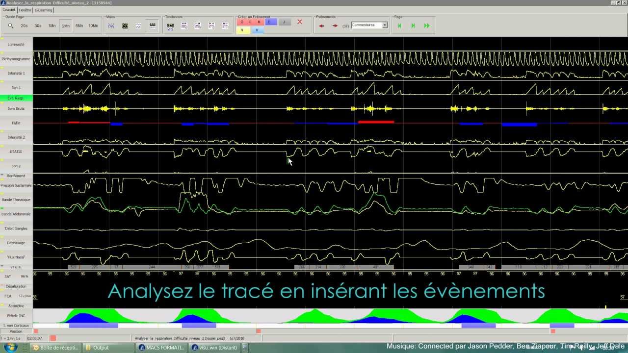 Formation en ligne à la lecture d'enregistrements polygraphiques et polysomnographiques YouTube Formation en ligne à la lecture d'enregistrements polygraphiques et polysomnographiques YouTube