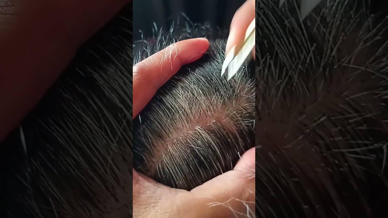 Самое приятное удаление седых волос #51 