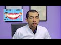 4  ازاي تختار دكتور تقويم ll How to choose your orthodontist ?