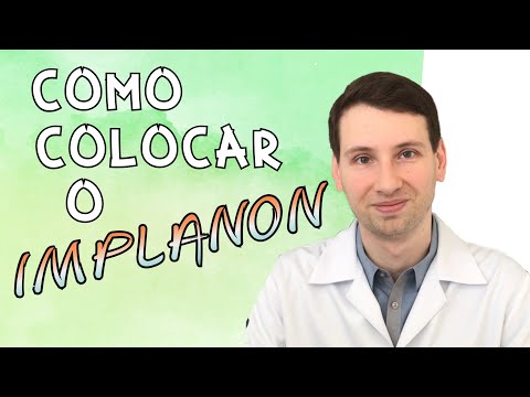 Vídeo: Como obter o Nexplanon: 11 etapas (com imagens)