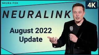 Neuralink Update – August 2022
