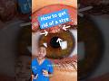 How to get rid of a stye