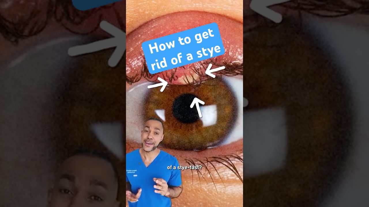 How to get rid of a stye