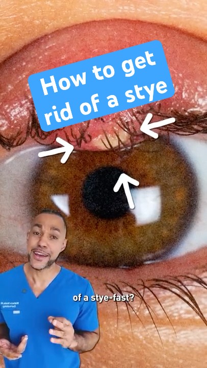 Download lagu How to get rid of a stye