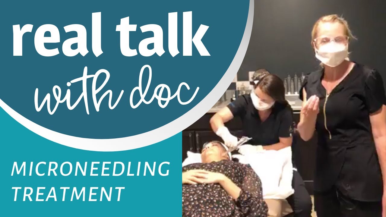 Watch A Live Microneedling Treatment YouTube