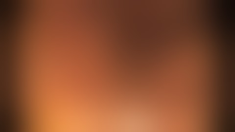 Cecum & Ascending Colon - Pseudopolyposis in IBD