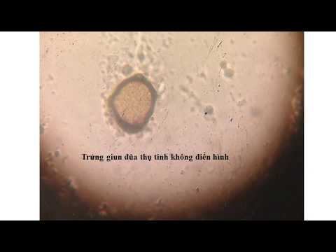 Video HÌNH THỂ TRỨNG MỘT SỐ LOẠI GIUN SÁN | TRỨNG GIUN ĐŨA... - youtube