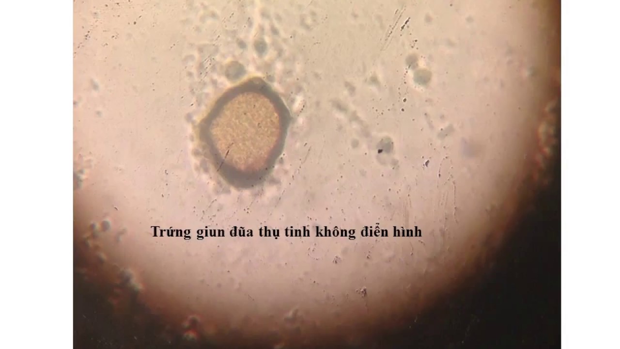 HÌNH THỂ TRỨNG MỘT SỐ LOẠI GIUN SÁN | TRỨNG GIUN ĐŨA MÓC TÓC KIM ...
