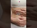 Disautonomía y Elhers Danlos (SED): los problemas digestivos parte 2
