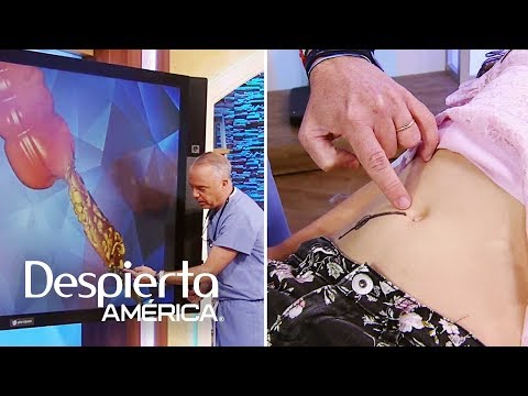 Q duele la lado apendice a