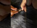 #fypviralシ #statisfying #lice #hair #LiceOnHead #liceremoval #brasil #xyzbcafyp #licecomb #kutu