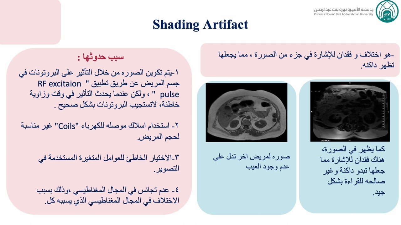 عيوب صور الرنين المغناطيسي /MRI artifacts