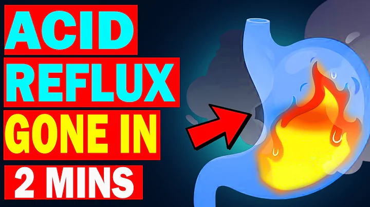 How To Treat Acid Reflux Naturally in Just 2 Minutes (Heartburn Relief)