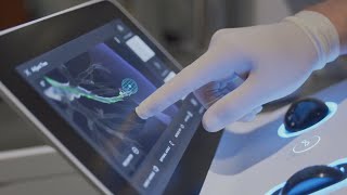 Novant Health uses new tech to improve early lung cancer detection
