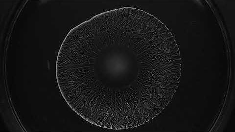 2021 Winner of the Gallery of Fluid Motion: The Yarning Droplet