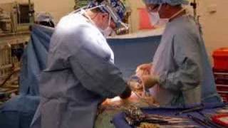 New chemo treatment helps remove abdominal cancers