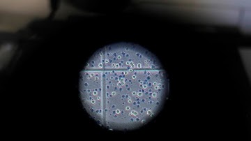 ‘Light at the end of the tunnel’ on vaccinations: Infectious diseases expert