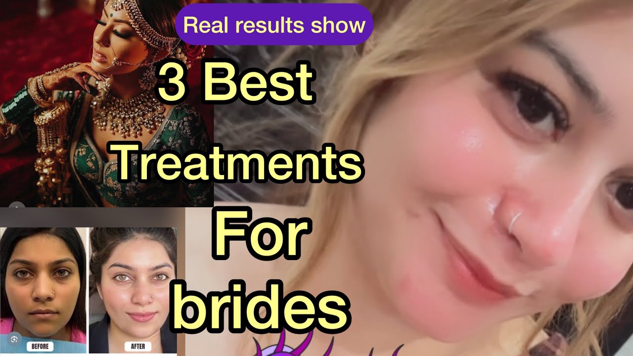 3BestTreatments to Every bride needs must| showing real results|No filter| best prices