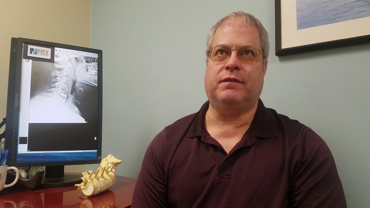 Right arm weakness corrected after ACDF surgery YouTube