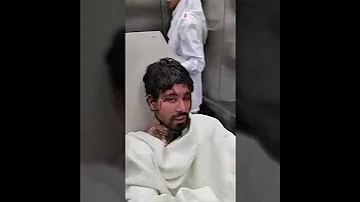 انفجار هاتف من الشحن 