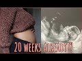 20 WEEK ULTRASOUND + BUMPDATE!