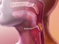 Learnvisible body  how the epiglottis works