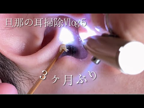 Видео: [耳掃除Vlog.5]大量！３ヶ月ぶりの耳掃除