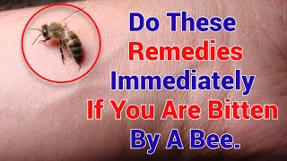 How To Reduce Swelling From A Bee Sting (Bee Sting Treatment)