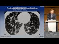 Chest - Pulmonary vasculitis and systemic diseases 1